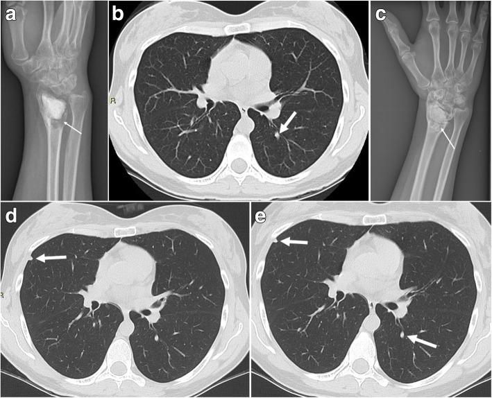 https://cdn.ncbi.nlm.nih.gov/pmc/blobs/05c3/7648999/8c70650c8c30/13018_2020_2038_Fig3_HTML.jpg