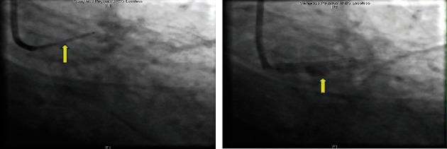 https://cdn.ncbi.nlm.nih.gov/pmc/blobs/05cd/7665934/4932ab097ca0/CRIC2020-8833917.004.jpg