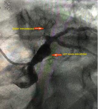 https://cdn.ncbi.nlm.nih.gov/pmc/blobs/05cd/7665934/d80d037f46e5/CRIC2020-8833917.002.jpg
