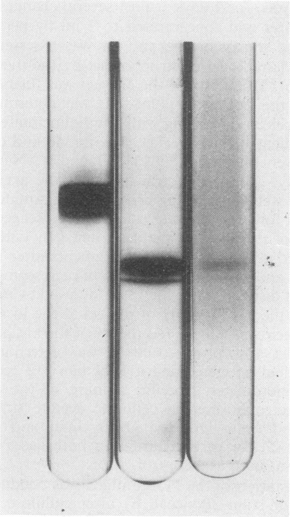 https://cdn.ncbi.nlm.nih.gov/pmc/blobs/05cf/416197/09bca1775e2c/iai00280-0058-a.jpg