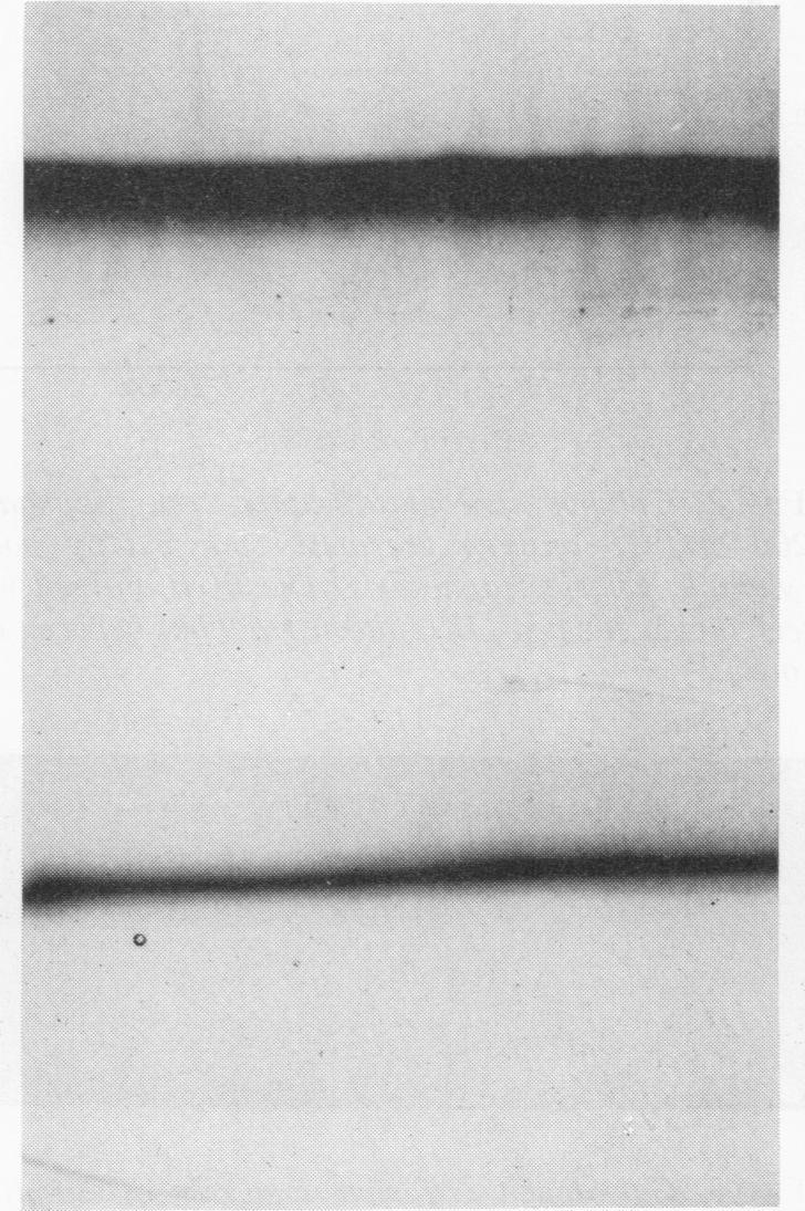 https://cdn.ncbi.nlm.nih.gov/pmc/blobs/05cf/416197/d516f7bb7db8/iai00280-0057-a.jpg