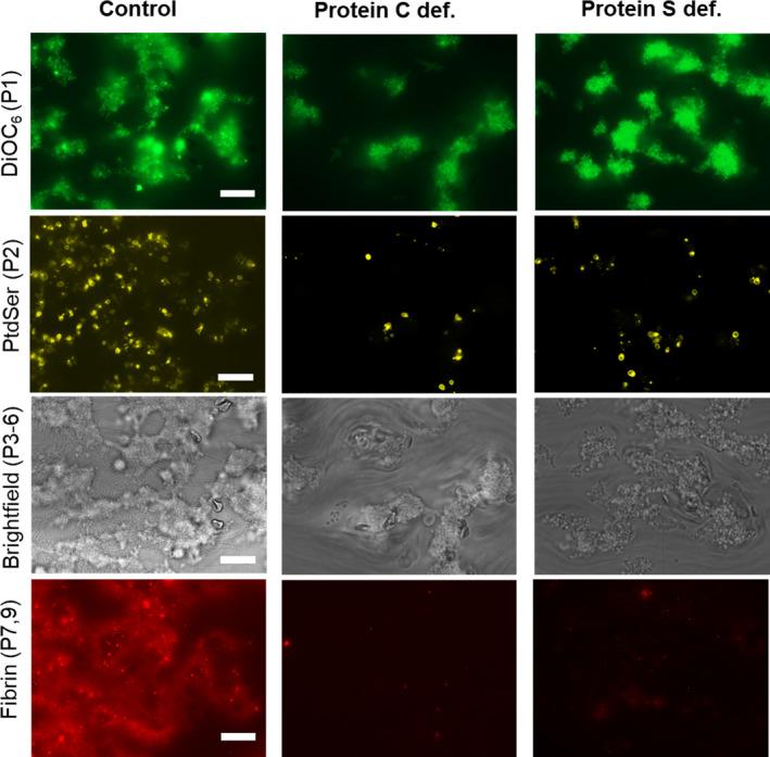 https://cdn.ncbi.nlm.nih.gov/pmc/blobs/05d2/8900581/4ad4333486dd/RTH2-6-e12678-g004.jpg