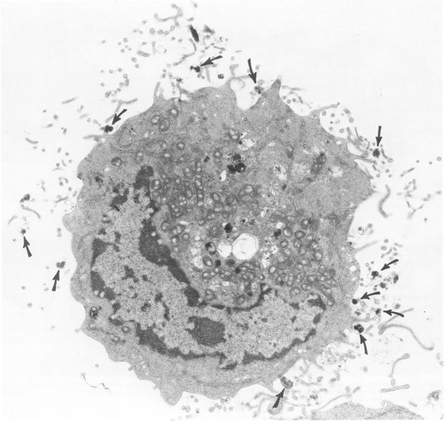https://cdn.ncbi.nlm.nih.gov/pmc/blobs/05d3/1899657/0922ae2ac1d1/amjpathol00150-0149-a.jpg