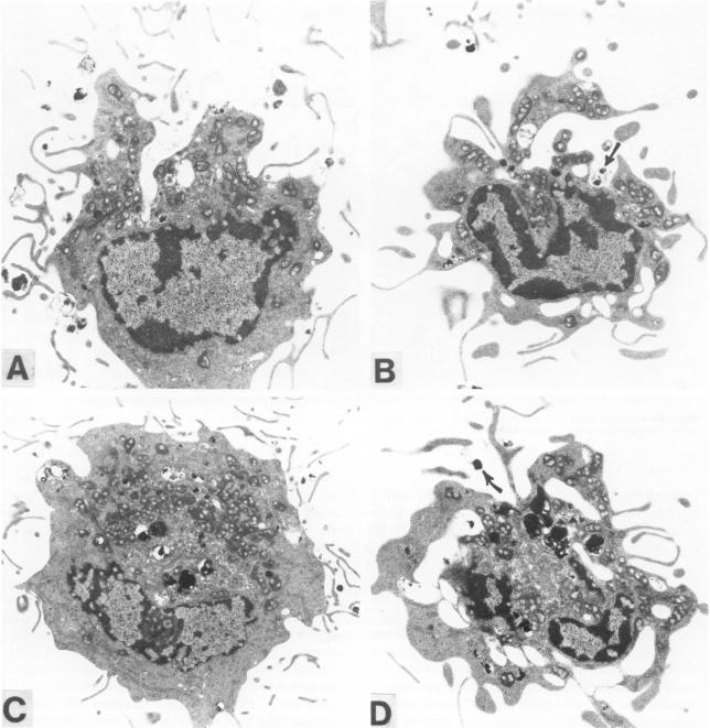 https://cdn.ncbi.nlm.nih.gov/pmc/blobs/05d3/1899657/b9a752a8e9fe/amjpathol00150-0151-a.jpg