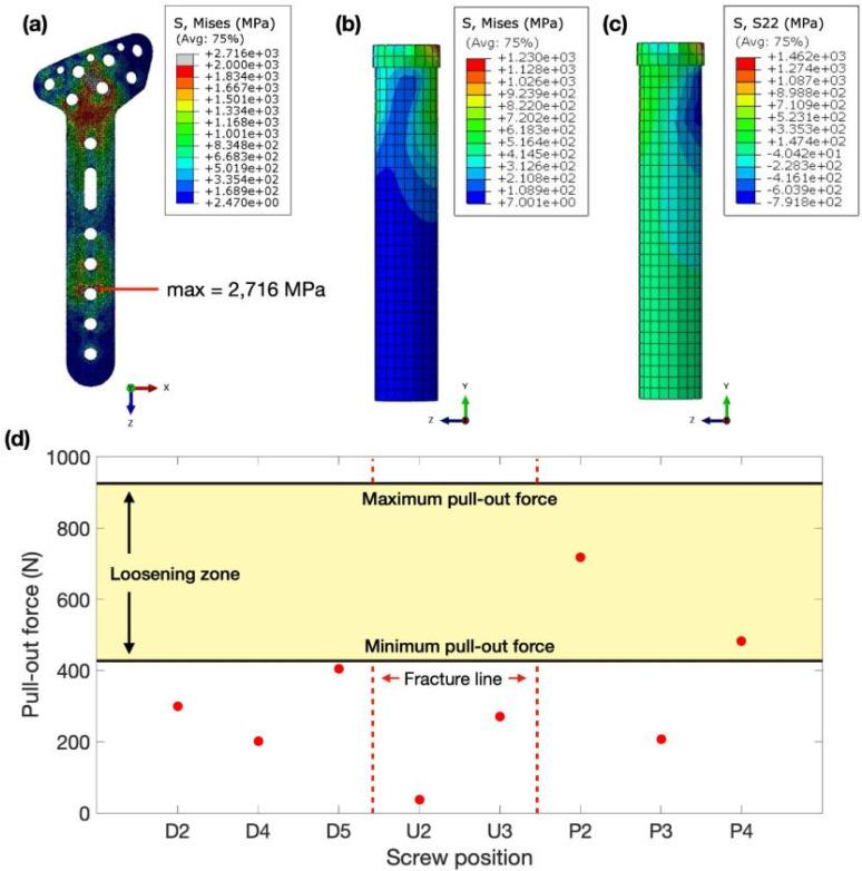 https://cdn.ncbi.nlm.nih.gov/pmc/blobs/05d4/12162135/eea58b9ad1a5/ABPID9-000009-026123_1-g005.jpg