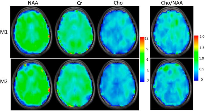 https://cdn.ncbi.nlm.nih.gov/pmc/blobs/05d5/4954958/1dd3dd856268/srep30066-f7.jpg
