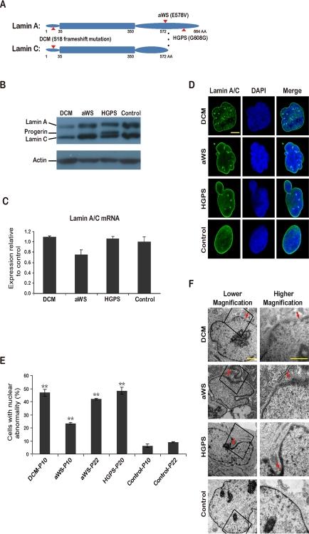 https://cdn.ncbi.nlm.nih.gov/pmc/blobs/05dc/3117453/bd084d9807d1/aging-03-380-g001.jpg