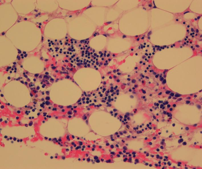https://cdn.ncbi.nlm.nih.gov/pmc/blobs/05e0/6637338/528202640145/CCR3-7-1285-g005.jpg