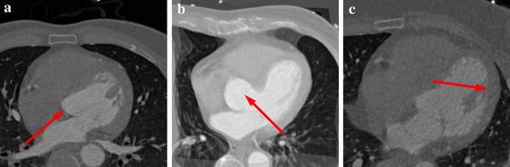https://cdn.ncbi.nlm.nih.gov/pmc/blobs/05e2/5370472/d05a2de48277/12938_2017_323_Fig3_HTML.jpg
