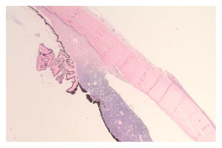https://cdn.ncbi.nlm.nih.gov/pmc/blobs/05ec/4706875/df41efef132f/CRIPA2015-380451.002.jpg