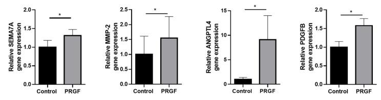 https://cdn.ncbi.nlm.nih.gov/pmc/blobs/05ed/8911300/6ef4dae25a7f/ijms-23-02827-g005.jpg