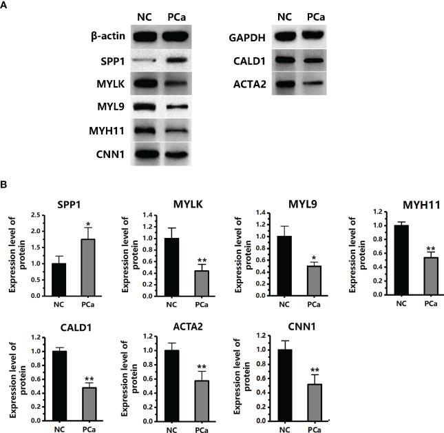 https://cdn.ncbi.nlm.nih.gov/pmc/blobs/05fe/10213256/16ada95db2ed/fonc-13-1168772-g007.jpg