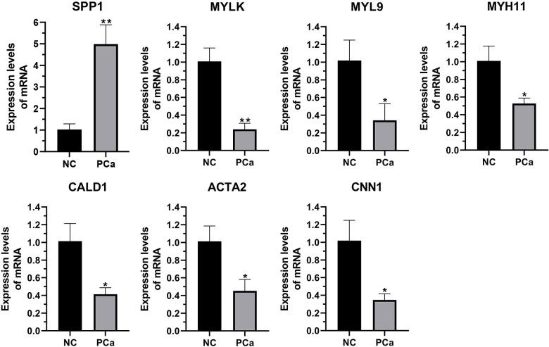 https://cdn.ncbi.nlm.nih.gov/pmc/blobs/05fe/10213256/bf457fa56906/fonc-13-1168772-g006.jpg