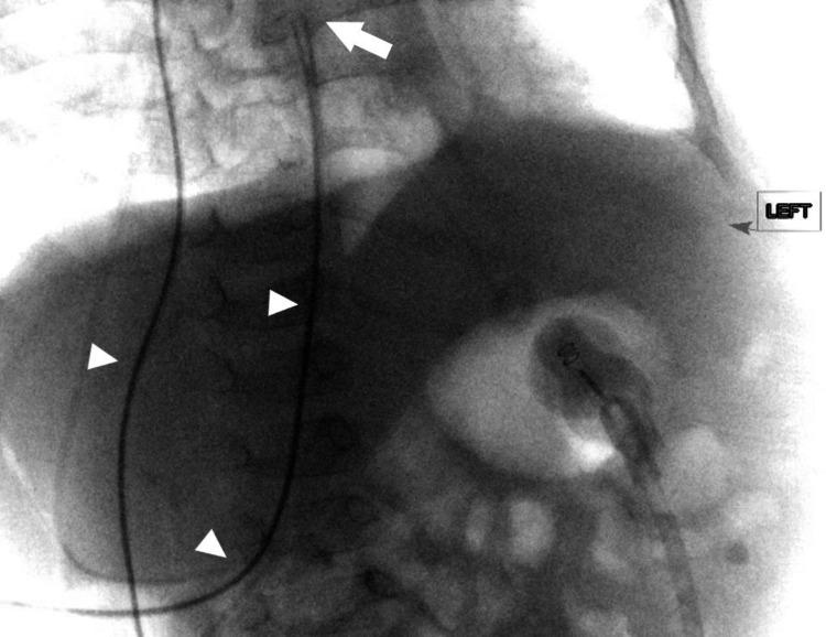 https://cdn.ncbi.nlm.nih.gov/pmc/blobs/0603/8865606/9782189fa576/cureus-0014-00000021555-i01.jpg