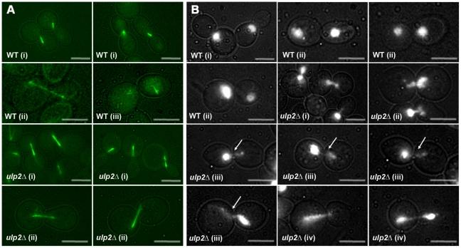 https://cdn.ncbi.nlm.nih.gov/pmc/blobs/060b/3069114/7eaa1b70bc62/pgen.1001355.g007.jpg
