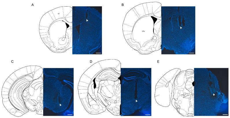 https://cdn.ncbi.nlm.nih.gov/pmc/blobs/060c/11394686/3fa858ac2d1e/ijms-25-09545-g004.jpg