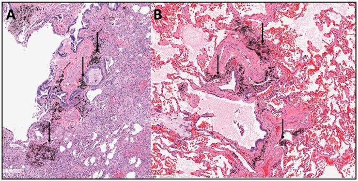 https://cdn.ncbi.nlm.nih.gov/pmc/blobs/060c/12429018/d6d9410d2632/ijms-26-08736-g001.jpg
