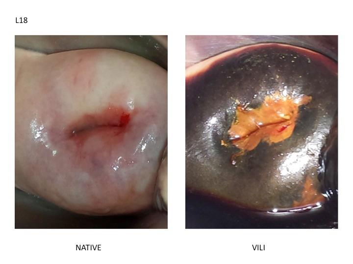 https://cdn.ncbi.nlm.nih.gov/pmc/blobs/060f/5468541/3ad515a8a72b/mhealth_v5i5e72_fig2.jpg