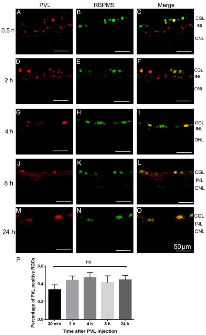 https://cdn.ncbi.nlm.nih.gov/pmc/blobs/0617/6266138/72355d9c646b/toxins-10-00455-g002.jpg