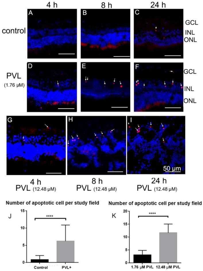 https://cdn.ncbi.nlm.nih.gov/pmc/blobs/0617/6266138/f67c1f0474bd/toxins-10-00455-g006.jpg