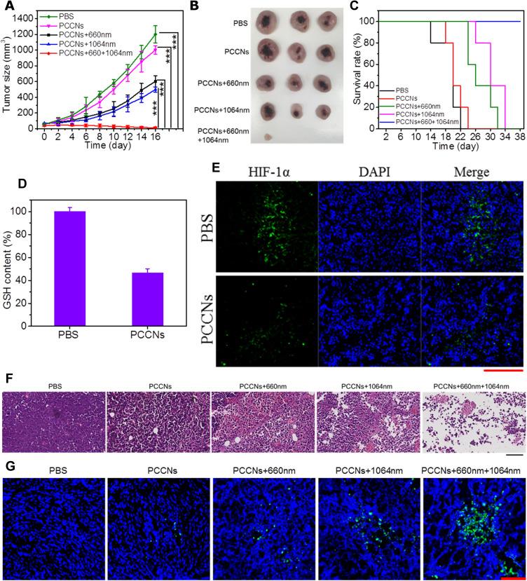 https://cdn.ncbi.nlm.nih.gov/pmc/blobs/0619/8275154/186c418fb159/IJN-16-4559-g0010.jpg