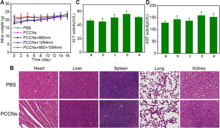 https://cdn.ncbi.nlm.nih.gov/pmc/blobs/0619/8275154/cb6ab37c691b/IJN-16-4559-g0011.jpg