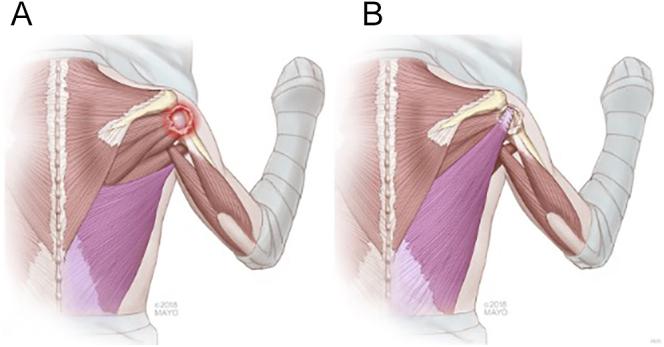 https://cdn.ncbi.nlm.nih.gov/pmc/blobs/061b/12412289/667c431d26ee/EOR-2024-0139fig3.jpg