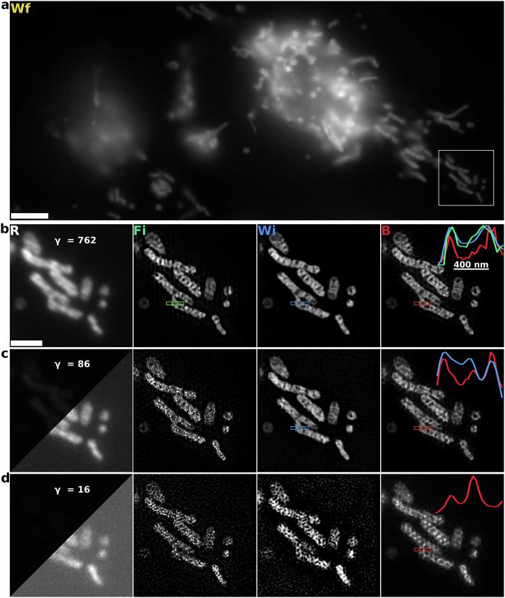 https://cdn.ncbi.nlm.nih.gov/pmc/blobs/062c/12091692/623804be463a/44303_2024_66_Fig3_HTML.jpg