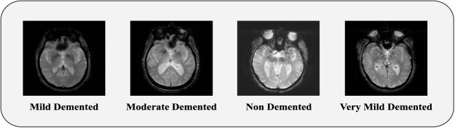 https://cdn.ncbi.nlm.nih.gov/pmc/blobs/0633/12405159/3208b49a304c/fbinf-05-1567219-g002.jpg