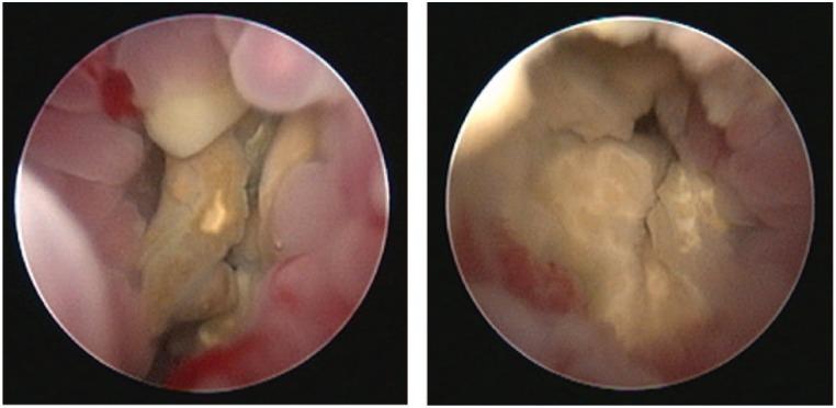 https://cdn.ncbi.nlm.nih.gov/pmc/blobs/0638/5362982/99648951346e/10.1177_2055116916653775-fig2.jpg