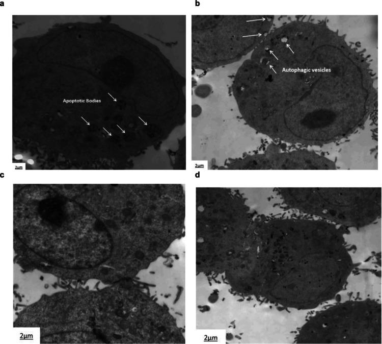 https://cdn.ncbi.nlm.nih.gov/pmc/blobs/063b/12141170/4ba594ad4a03/10142_2025_1615_Fig7_HTML.jpg