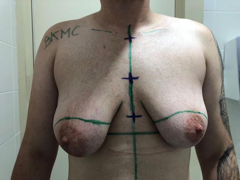 https://cdn.ncbi.nlm.nih.gov/pmc/blobs/063d/12366932/da546906d679/gox-13-e7006-g013.jpg