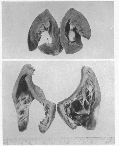 https://cdn.ncbi.nlm.nih.gov/pmc/blobs/063e/503658/0897b07d9405/brheartj00403-0008-a.jpg