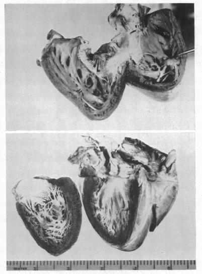 https://cdn.ncbi.nlm.nih.gov/pmc/blobs/063e/503658/0e3e5b22e358/brheartj00403-0007-a.jpg