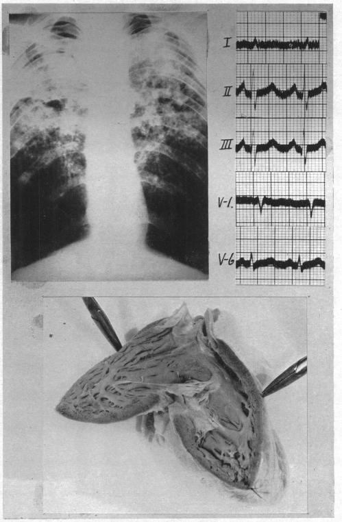 https://cdn.ncbi.nlm.nih.gov/pmc/blobs/063e/503658/ed3810629717/brheartj00403-0009-a.jpg
