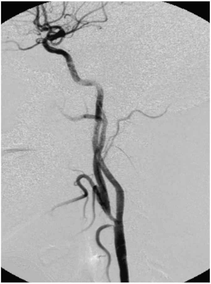 https://cdn.ncbi.nlm.nih.gov/pmc/blobs/063f/2667617/22b5866e69f8/kjr-7-292-g004.jpg