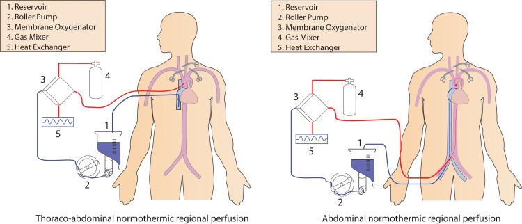 https://cdn.ncbi.nlm.nih.gov/pmc/blobs/0645/9246458/34f9c7a687aa/cureus-0014-00000026437-i01.jpg