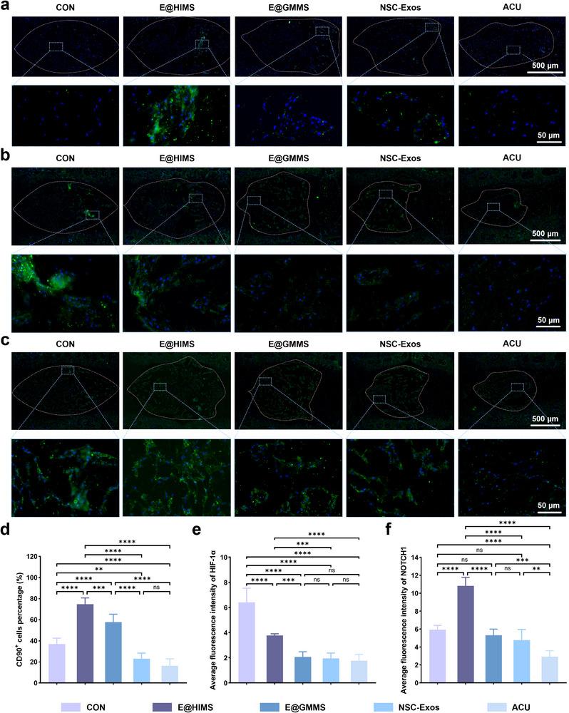 https://cdn.ncbi.nlm.nih.gov/pmc/blobs/0648/12165120/8f3938c9da7b/ADVS-12-2417570-g002.jpg