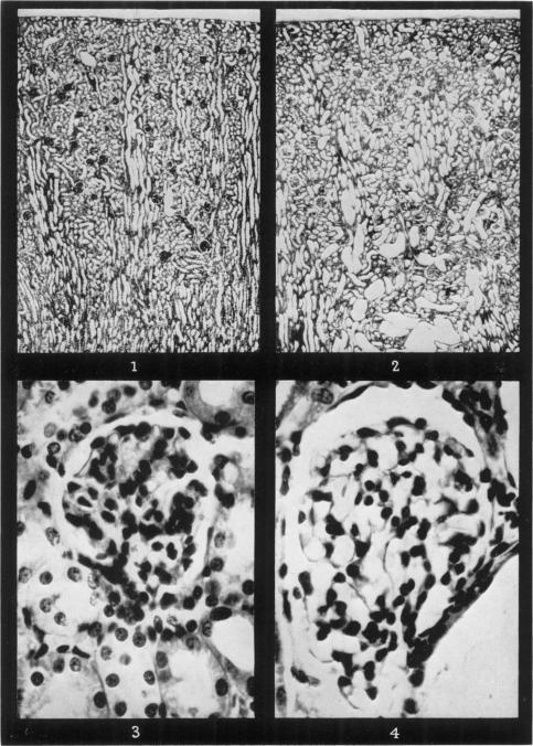 https://cdn.ncbi.nlm.nih.gov/pmc/blobs/064a/2082366/1acd0bf9b88f/brjexppathol00362-0058-a.jpg