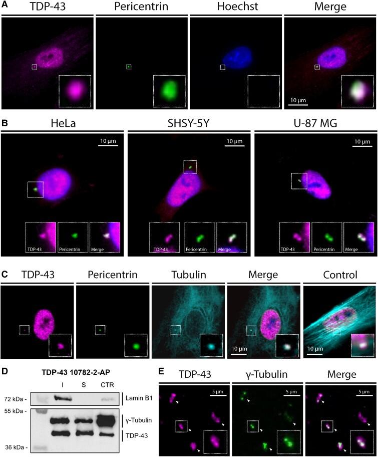 https://cdn.ncbi.nlm.nih.gov/pmc/blobs/064b/10473568/092504527b54/awad228f1.jpg