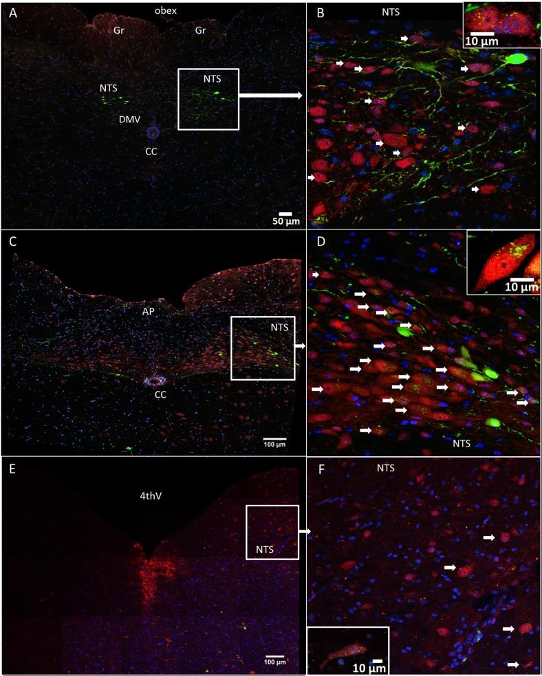 https://cdn.ncbi.nlm.nih.gov/pmc/blobs/064b/4368564/ca6954ff7548/pone.0119034.g008.jpg