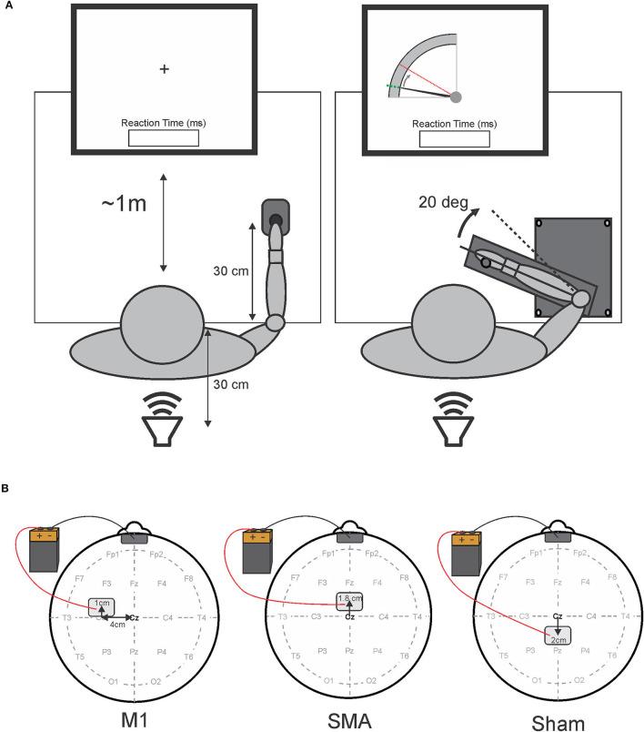https://cdn.ncbi.nlm.nih.gov/pmc/blobs/0658/9237404/df5b81cde9e9/fneur-13-913517-g0001.jpg
