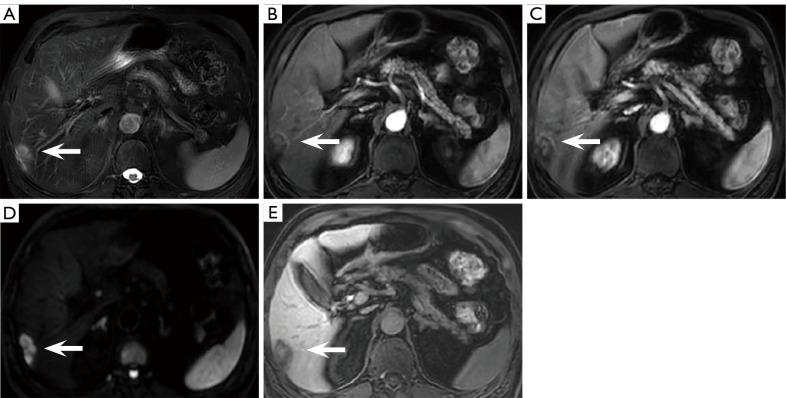 https://cdn.ncbi.nlm.nih.gov/pmc/blobs/0660/11651963/4622091161c1/qims-14-12-8520-f7.jpg