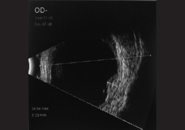 https://cdn.ncbi.nlm.nih.gov/pmc/blobs/066d/3120247/3fe43634a8e8/IJO-59-233-g004.jpg