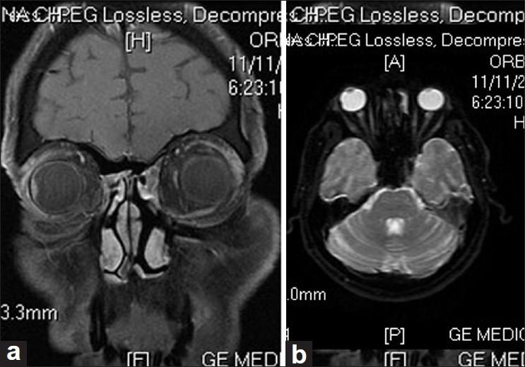 https://cdn.ncbi.nlm.nih.gov/pmc/blobs/066d/3120247/f8210ade1b25/IJO-59-233-g005.jpg