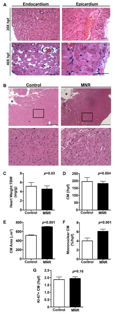https://cdn.ncbi.nlm.nih.gov/pmc/blobs/0675/6265071/89721f1e17cb/nihms970021f6.jpg