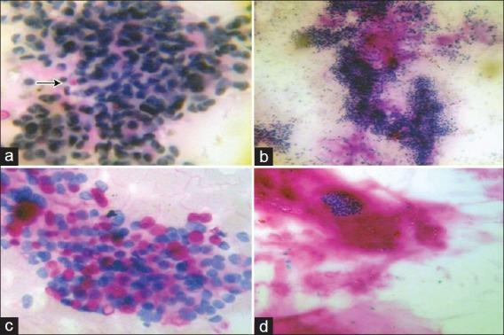 https://cdn.ncbi.nlm.nih.gov/pmc/blobs/0678/3543588/0c0a772950ee/JCytol-29-221-g003.jpg