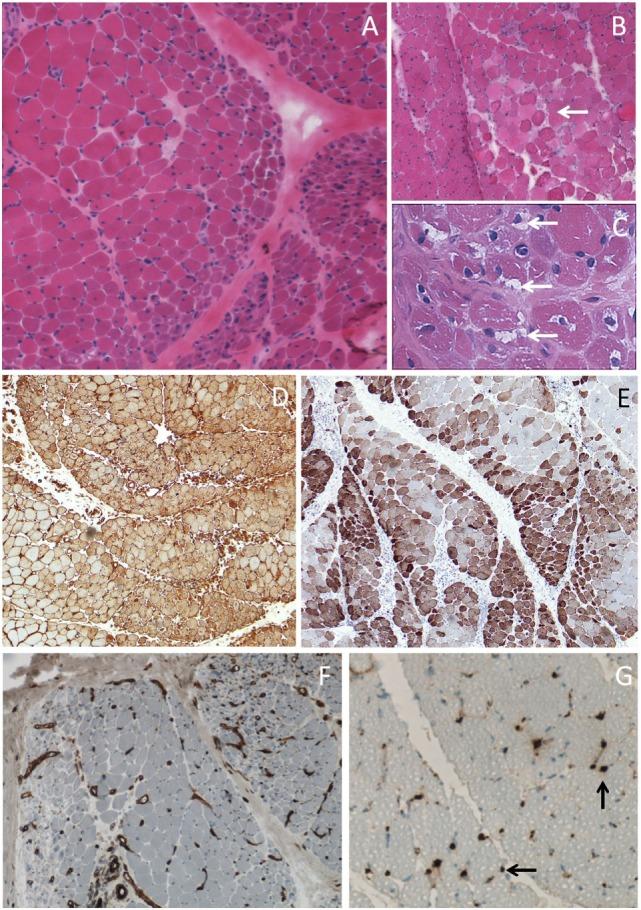 https://cdn.ncbi.nlm.nih.gov/pmc/blobs/0678/5566616/fe2d3590053a/fimmu-08-00992-g002.jpg