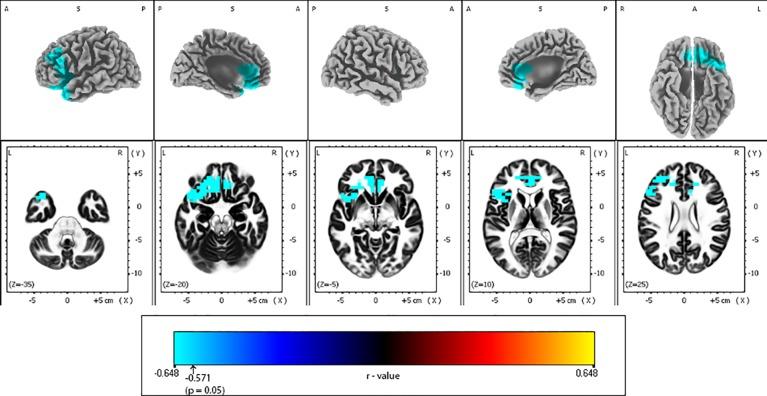 https://cdn.ncbi.nlm.nih.gov/pmc/blobs/0678/7057228/e32b87f3d279/fpsyt-11-00083-g004.jpg