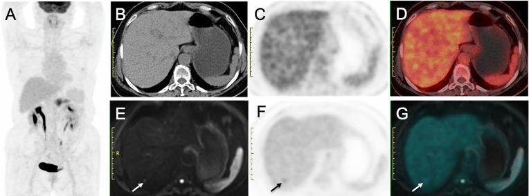 https://cdn.ncbi.nlm.nih.gov/pmc/blobs/0679/8794800/fffdfe83ea59/fonc-11-790462-g003.jpg
